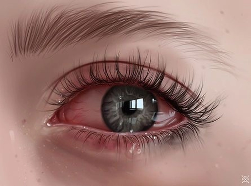 dp eyes crying